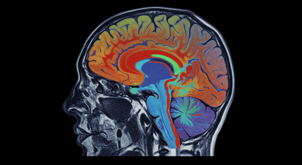 Imagen de resonancia magnética del cerebro humano con colores vibrantes. Representación médica para contenido de neurología y neurociencia.