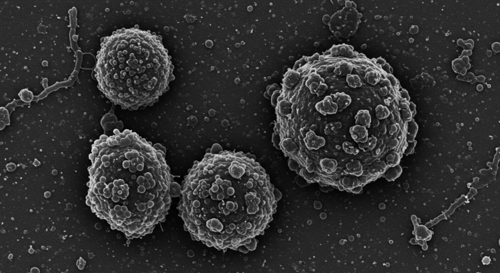 Las 5 pandemias más letales de la historia que sacudieron al mundo 6 "Micrografía electrónica de virus en blanco y negro. Imagen científica de partículas virales con estructura interna visible. Ideal para contenido médico y de investigación virológica."