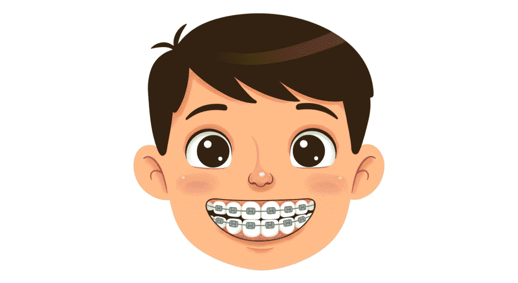 Alineadores Dentales vs Brackets: ¿Cuál Es Mejor Para Ti? 5 Alineadores Dentales vs Brackets: ¿Cuál Es Mejor Para Ti? | 1