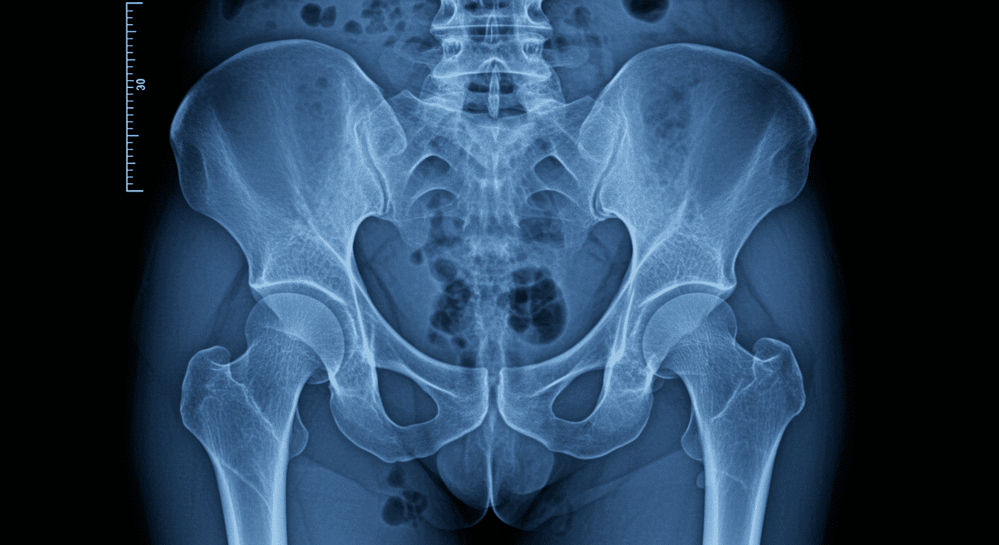 Radiación: qué es, cómo funciona y por qué es tan importante 6 "Radiografía de la pelvis humana. Imagen médica mostrando la estructura ósea de la cadera. Diagnóstico médico, rayos X, esqueleto humano, anatomía."